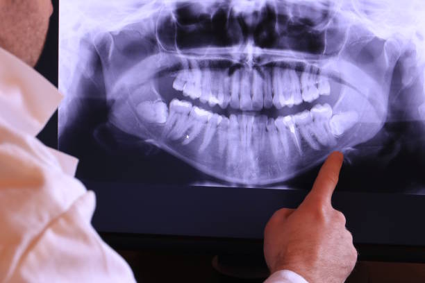 Best Emergency Root Canal Treatment in Nevada City, CA