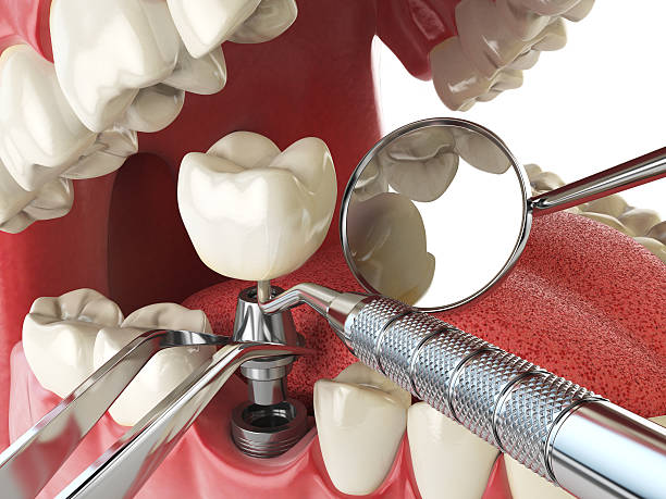 Best Emergency Orthodontic Repairs in Nevada City, CA